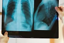SFR et Fujifilm invitent le secteur médical à travailler sur  [...]