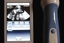 Les smartphones au service de la santé