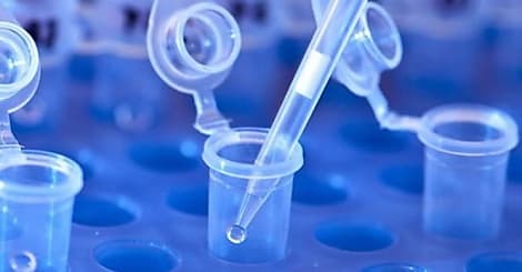 L'ouverture des données de santé fait débat à l'Assemblée